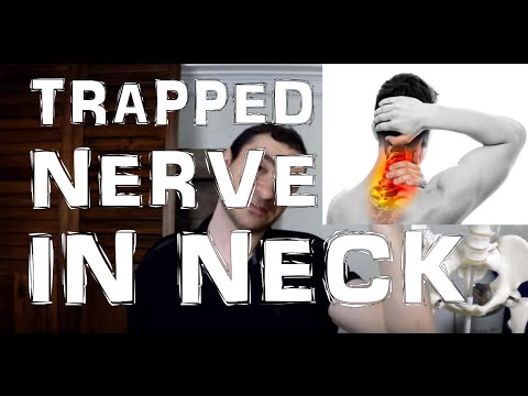 Trapped Nerve In Neck From Tight Scalene Muscles - YouTube