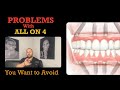 Problems with ALL ON 4 Dental Implants