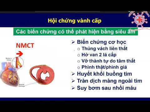 [ SIÊU ÂM TIM ] - BỆNH TIM THIẾU MÁU CỤC BỘ