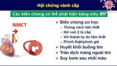 [ SIÊU ÂM TIM ] - BỆNH TIM THIẾU MÁU CỤC BỘ
