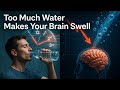 What Happens If You Drink Too Much Water Too Fast? | Water Intoxication Explained