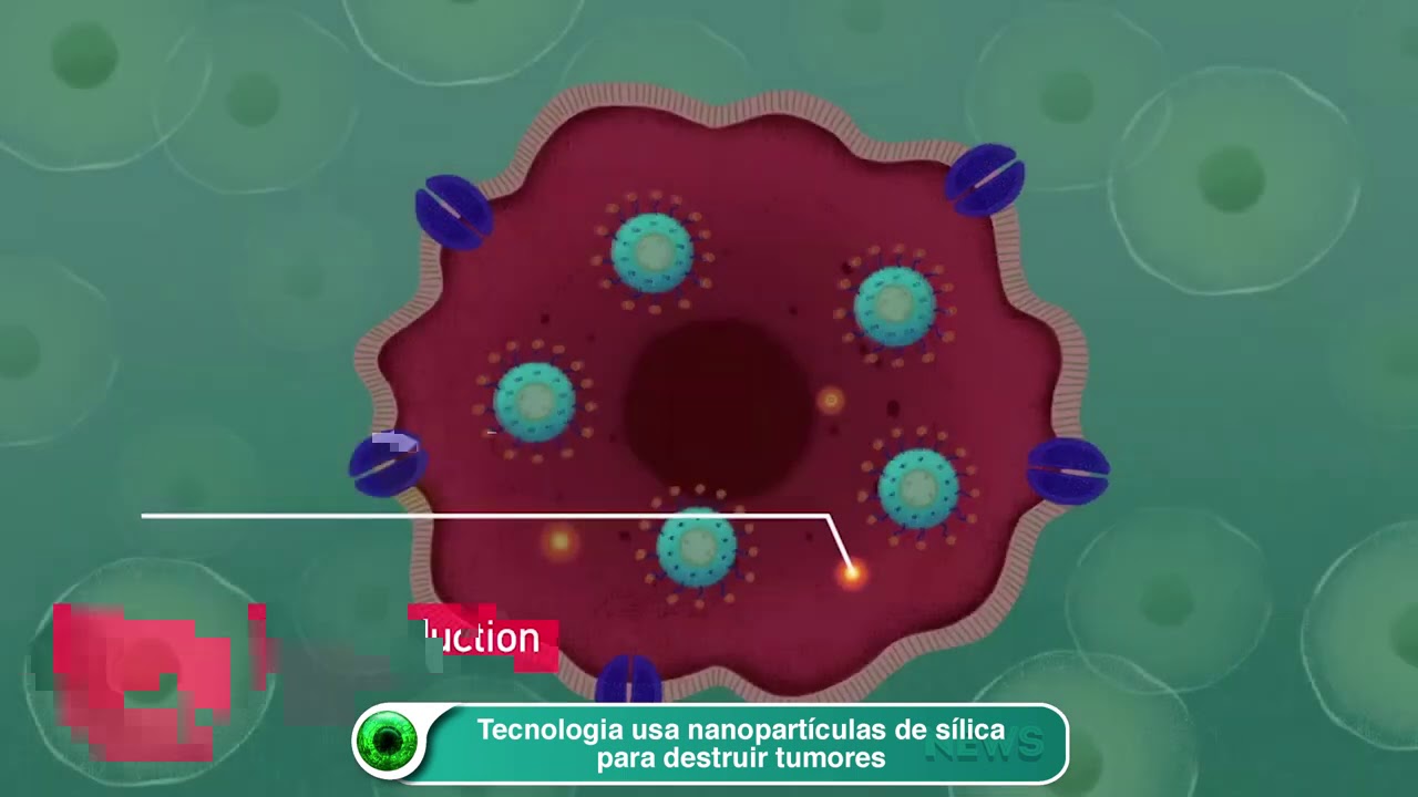Tecnologia usa nanopartículas de sílica para destruir tumores