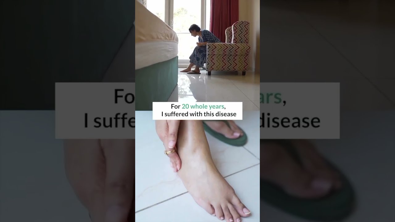 Cured My Arthritis In 3 Months Left Doctors Shocked
