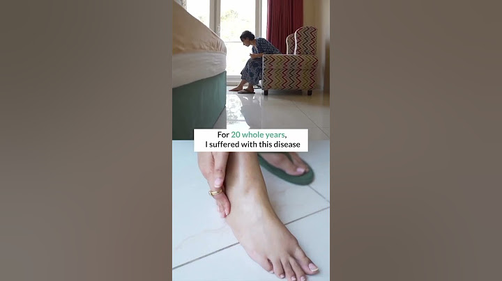 Cured My Arthritis in 3 Months | Left Doctors Shocked