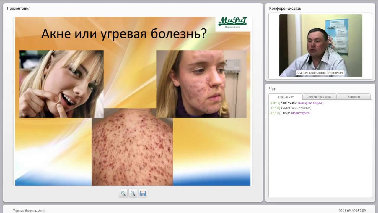 угревая сыпь фото онлайн