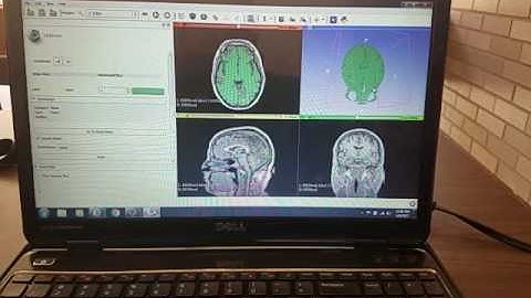 ECE 7400 Assignment 3 3D Slicer