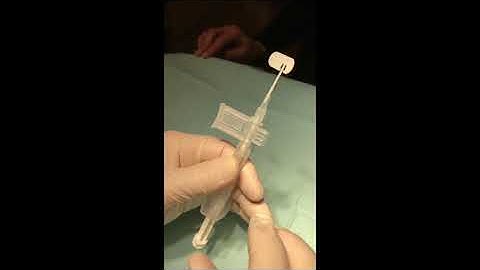 SofPort EZ-24 Lens Delivery System Demonstration by Steven G. Safran MD
