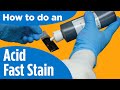 How to do an acidfast stain  instructions for the labprocedure