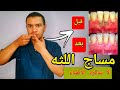 Gum Massage To Treat Gum Recession And Gingivitis Why Don T Doctors Mention It