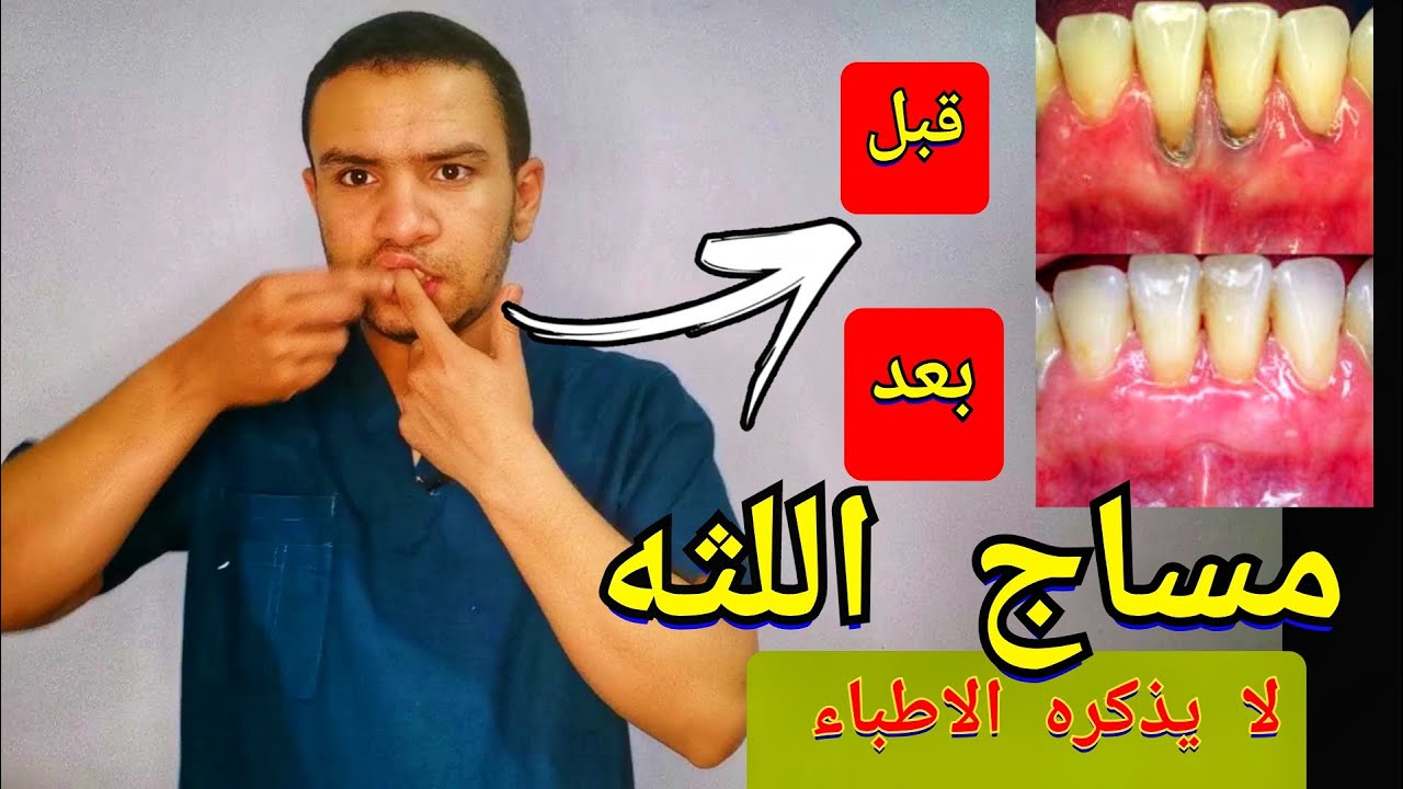 تدليك ( مساج اللثه) للتخلص من تراجع اللثه و التهاب اللثه | لماذا لا يذكرها الاطباء