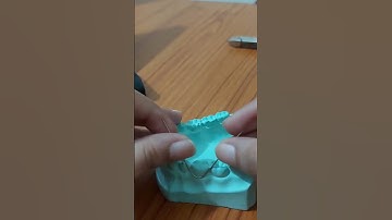 Making Adams Clasp for Orthodontics posting #dentalcollege #orthodontics