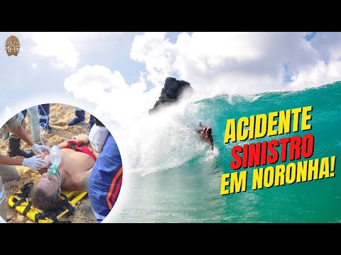 Acidente em Fernando de Noronha: o que aconteceu com o bodysurfer Henrique Pistilli , o Homem Peixe?