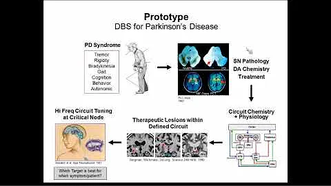 Neurocircuitry and DBS for the Management of Depression - DayDayNews