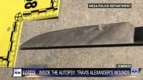 Jodi Arias trial: See Travis Alexander's autopsy