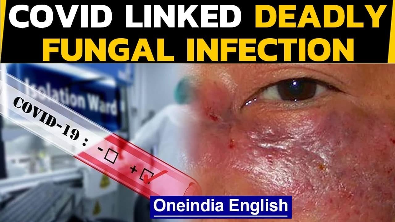 Black Fungal Infection Triggered By Covid 19 All About Mucormycosis Oneindia News Youtube