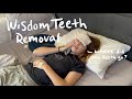 Krista Got Her Wisdom Teeth Removed! | taking care of my girlfriend after surgery