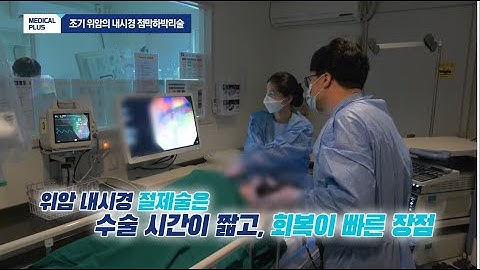 [메디컬플러스]  조기 위암의 내시경 점막하박리술 _ 신현덕 교수(단국대병원 소화기내과)