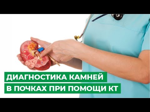 ДИАГНОСТИКА КАМНЕЙ В ПОЧКАХ ПРИ ПОМОЩИ КТ 🔎 МЦ МИРТ