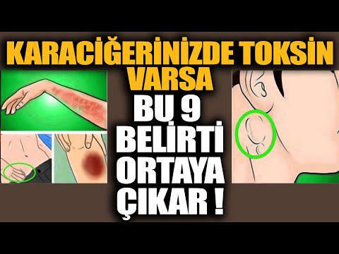 Video: Biotinin aktiv forması hansıdır?