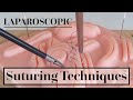 Laparoscopic suturing techniques