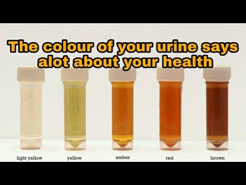 What color is healthy urine?