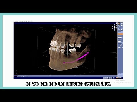 CT Scan ดีอย่างไร จำเป็นไหมที่ต้องทำ?