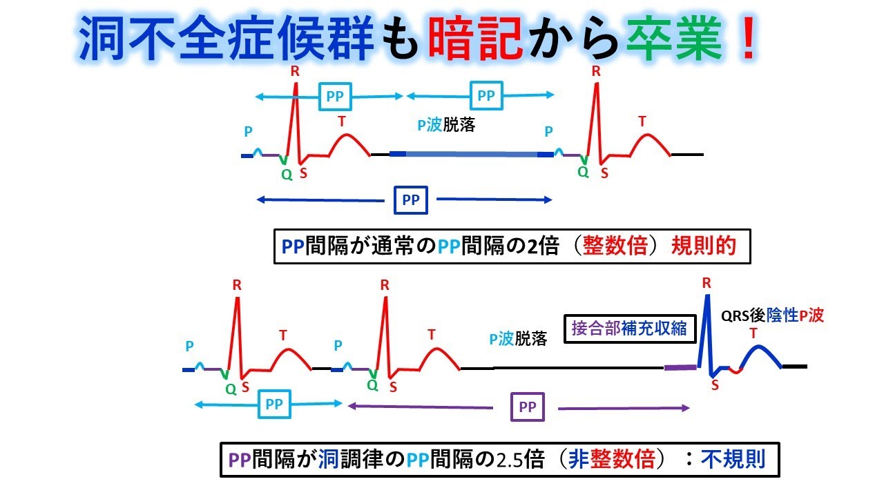 ゼルウィガー症候群に関するよくある質問