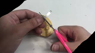 Fabrication Of Lower Lingual Holding Arch