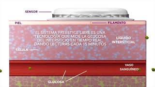 Monitoreo Continuo Glucosa- Freestyle Libre