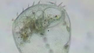 Stentor sp. Protozoo ciliado