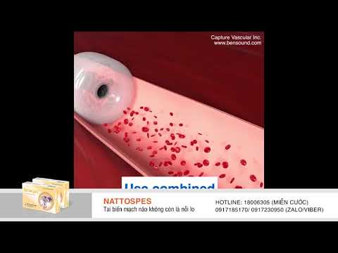 Video: 5 cách để làm tan cục máu đông