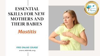 Breastfeeding Mastitis - ESSENTIAL SKILLS FOR NEWMOTHERS AND THEIR BABIES