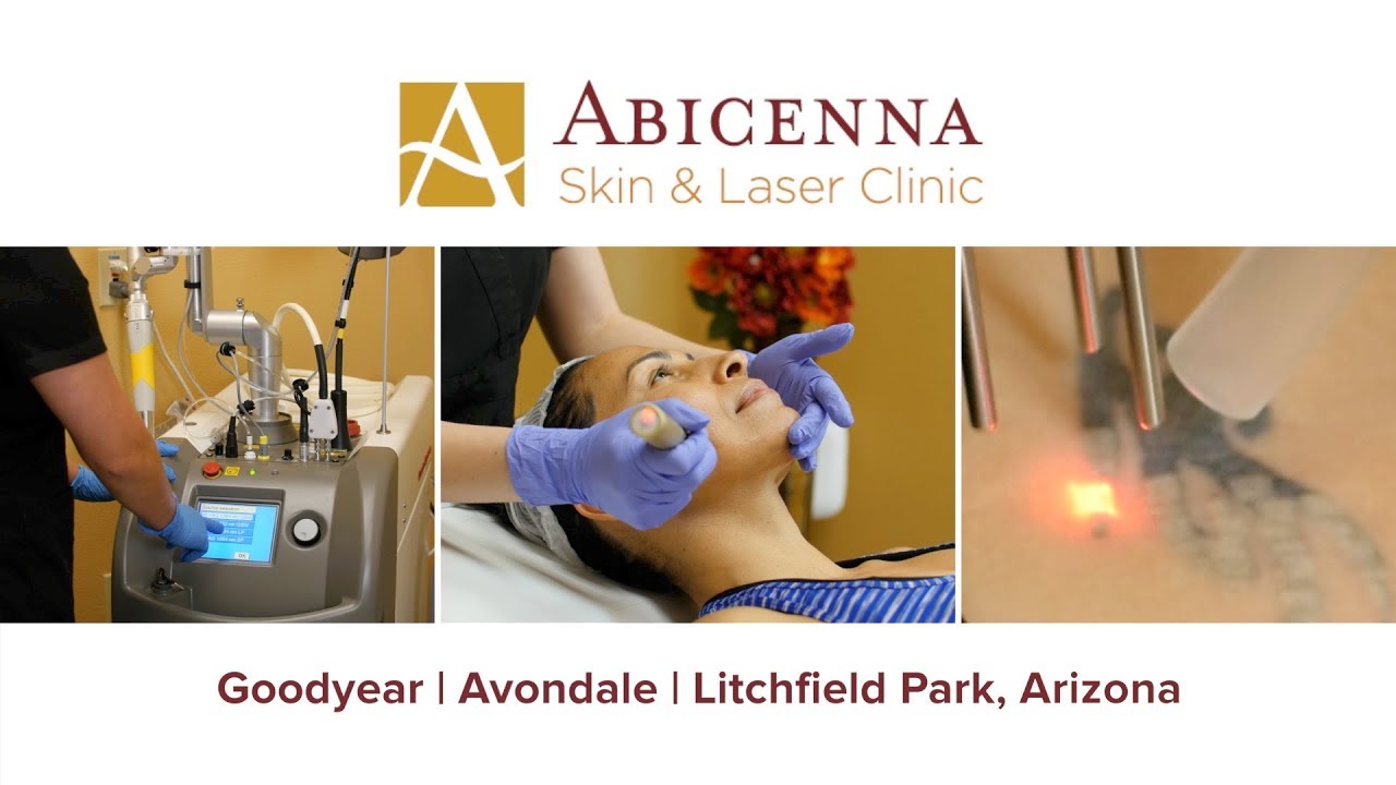 Laser Hair Removal Goodyear AZ Abicenna Skin and Laser Clinic YouTube