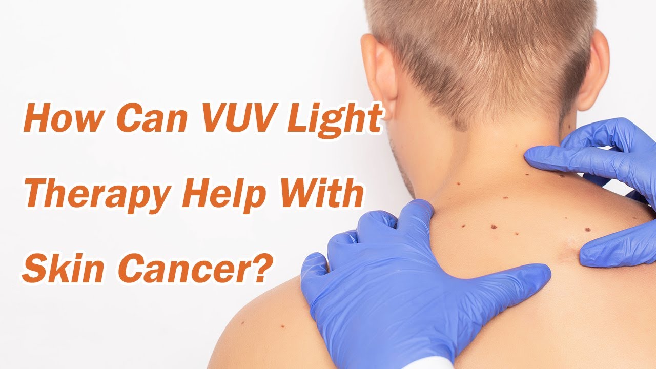 How Can VUV Light Therapy Help with Skin Cancer？ YouTube