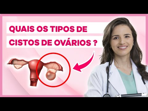 Tipos de Cisto