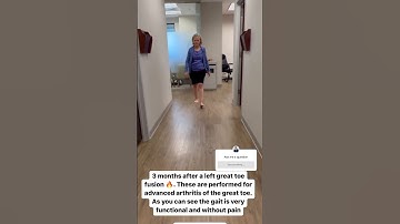 3 MONTHS AFTER GREAT TOE FUSION