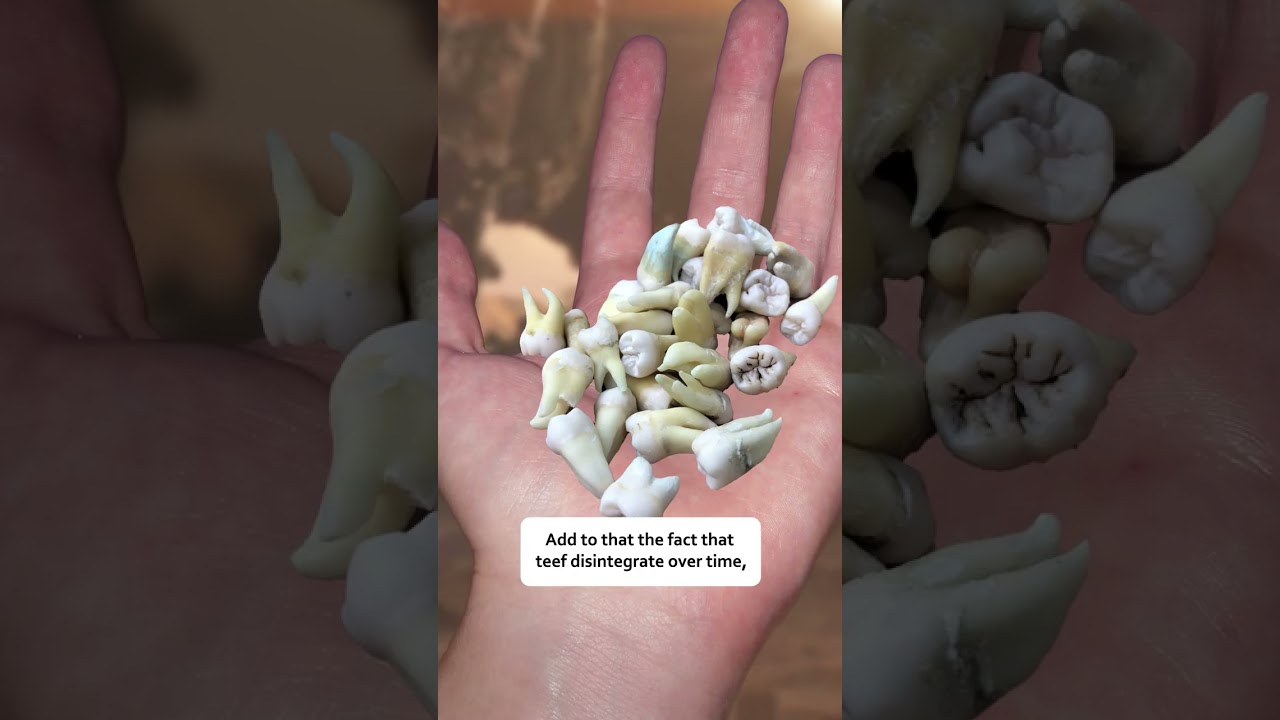 Why Ork Teeth Are More Important Than You'd Expect..