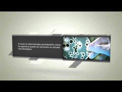 ¿Cuál es la mejor pasta de dientes para la periodontitis y gingivitis? actualización 2023 3