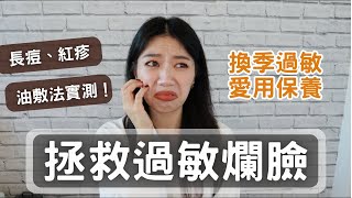 換季過敏爛臉拯救丹妮婊姐油敷法實驗敏感肌膚脫皮起疹紅癢痛皮膚過敏愛用保養品 Cerave/理膚寶水/倍優B5/契爾氏全面精準修復霜  #ashley #ashlife #換季 #過敏 #敏感肌