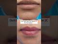 Dark lips? Stop this mistake ❌ Try this gentle lip care instead 💋