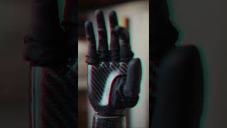 Bionic Hand: Future ka Haath Jo Dimaag Se Chalta Hai!