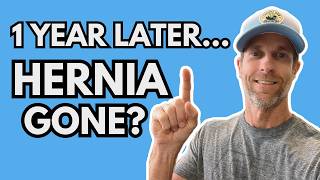 Natural Hernia Repair Status After One Year Of NO Hernia Exercises | Dietary Changes