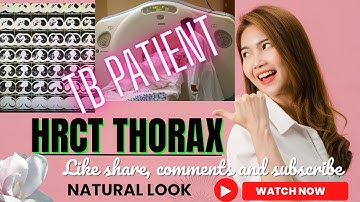 HRCT THORAX | TB | Mycobacterium Tuberculosis | CT chest/Lungs | full Information #hrctthorax #tb🔥