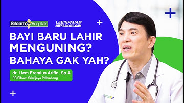 Waspada Bayi Kuning! Kenali Penyebab Dan Apa Yang Harus Dilakukan Untuk Mengatasinya