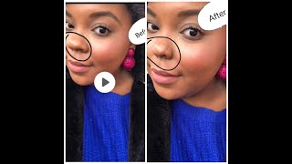 Look More Beautiful With Magical Instabeauty App That Hide Your Face Errors #BigNose #Hideempties screenshot 4