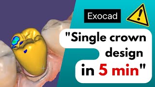 Single Crown Design in Exocad – Under 5 Minutes!تاج مفرد في Exocad