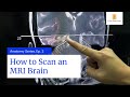 How to scan an mri brain