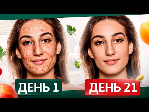 Видео: Красивая кожа без прыщей и морщин за 21 дней: питание и психосоматика