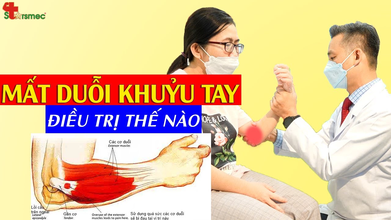 Mất duỗi khuỷu tay - Điều trị và chăm sóc thế nào? | Y học Thể thao Starsmec