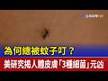 為何總被蚊子叮？ 美研究揭人體皮膚「3種細菌」元凶